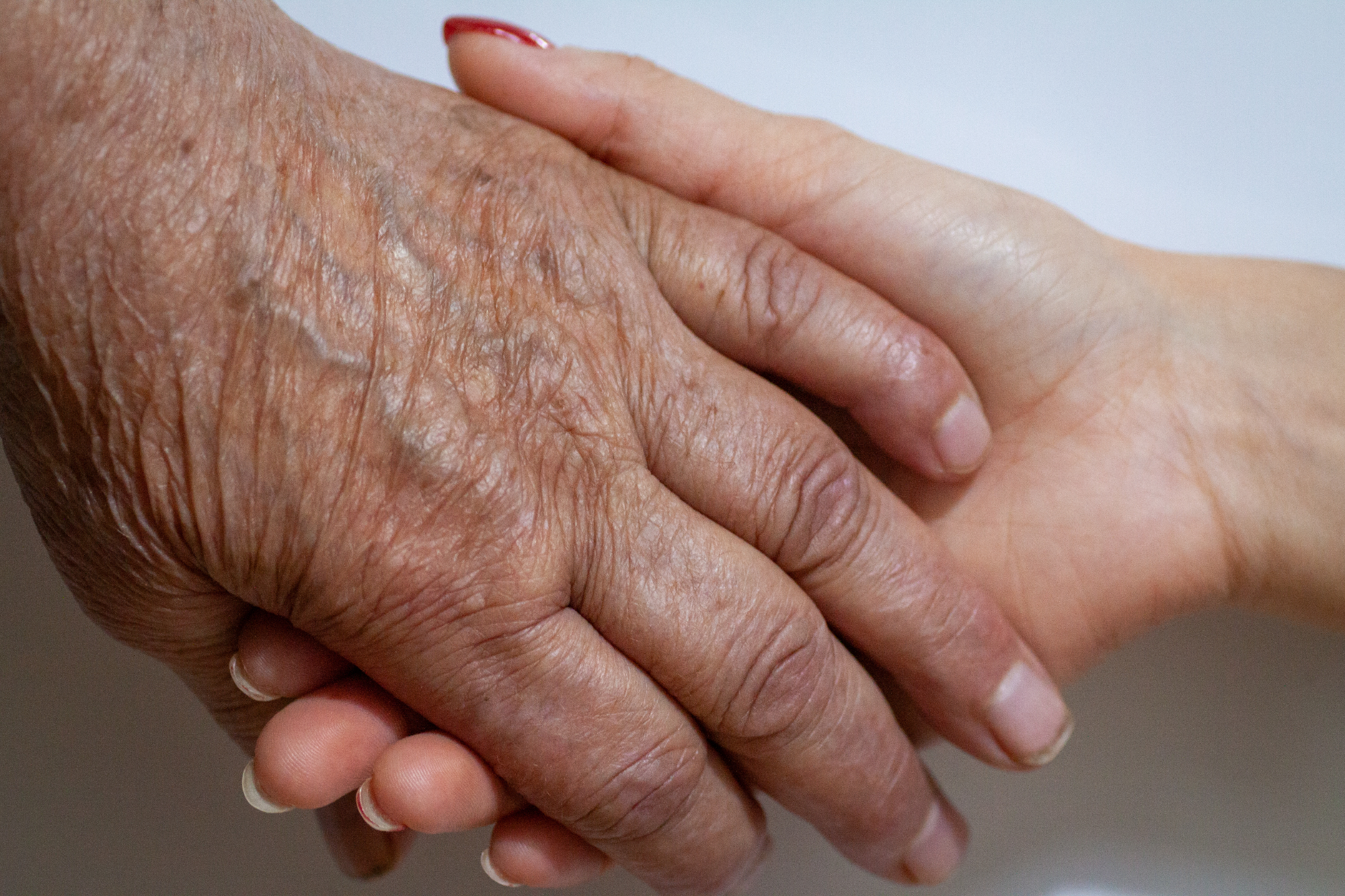 Revmatoidni artritis je danes zelo pogosta vnetna bolezen pri starejših